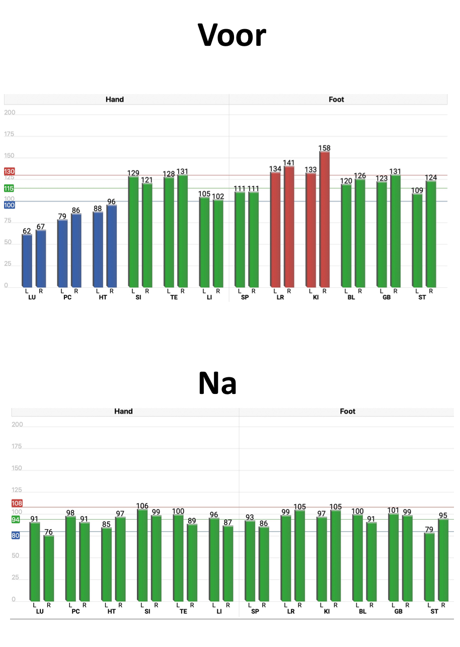 Energiemeting met de Acugraph bij A Healthy Qi - Acupunctuur in Friesland