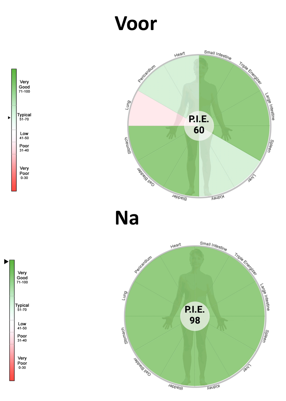 P.I.E score na doormeten met de Acugraph bij A Healthy Qi - Acupunctuur in Friesland